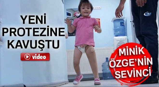 Antalyalı minik Özge yeni protezine kavuştu