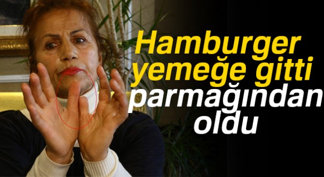 Hamburger yemeğe gitti, parmağından oldu