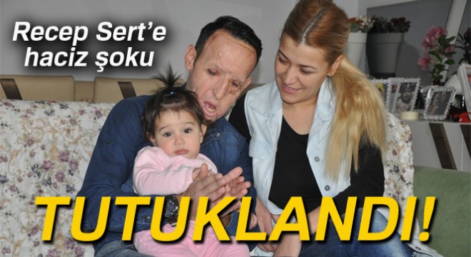 Yüz nakli olan Sert cezaevinde